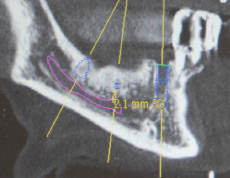  Zahnersatz & Ästhetik 